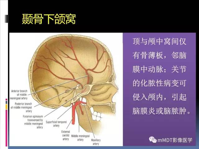 【PPT】颞下颌关节的磁共振成像(检查技术与解剖部分)