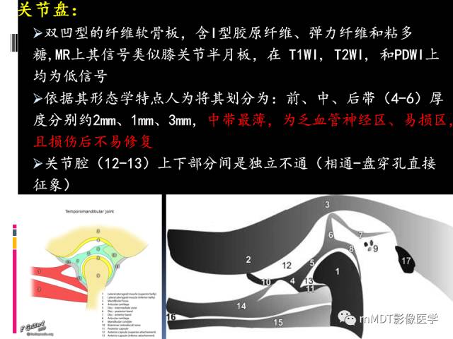 【PPT】颞下颌关节的磁共振成像(检查技术与解剖部分)
