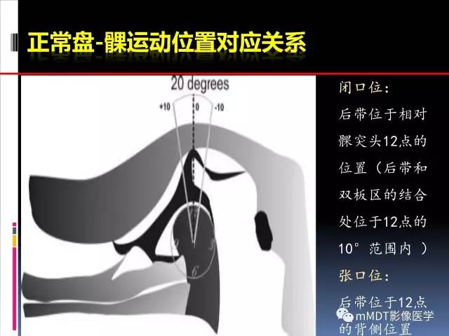 【PPT】颞下颌关节的磁共振成像(检查技术与解剖部分)