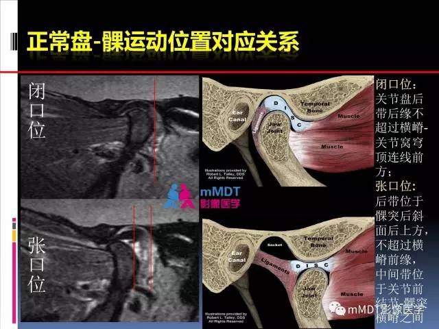 【PPT】颞下颌关节的磁共振成像(检查技术与解剖部分)