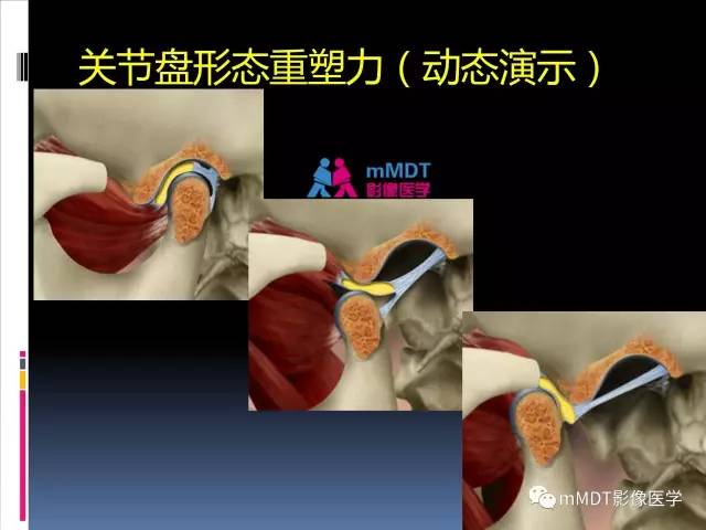 【PPT】颞下颌关节的磁共振成像(检查技术与解剖部分)