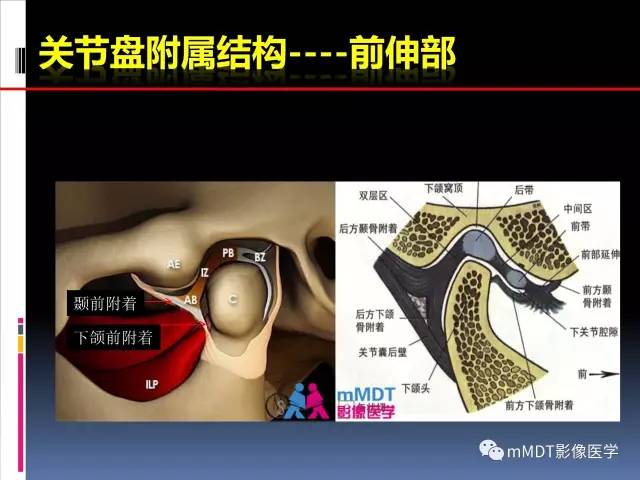 【PPT】颞下颌关节的磁共振成像(检查技术与解剖部分)