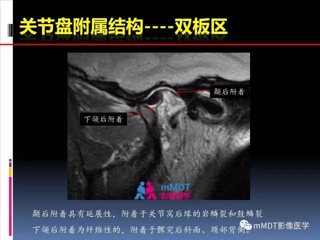 【PPT】颞下颌关节的磁共振成像(检查技术与解剖部分)
