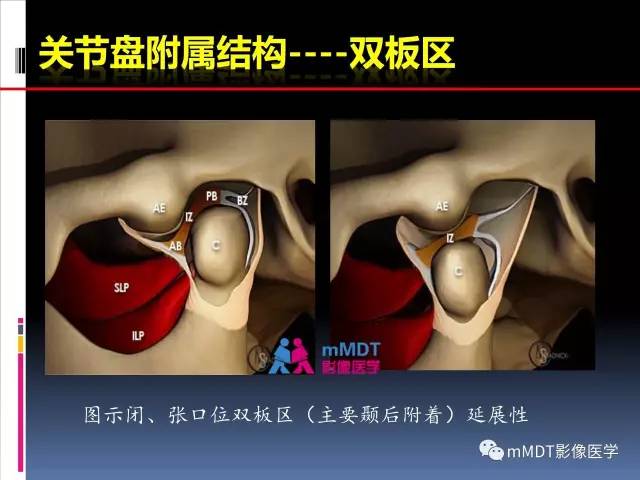 【PPT】颞下颌关节的磁共振成像(检查技术与解剖部分)