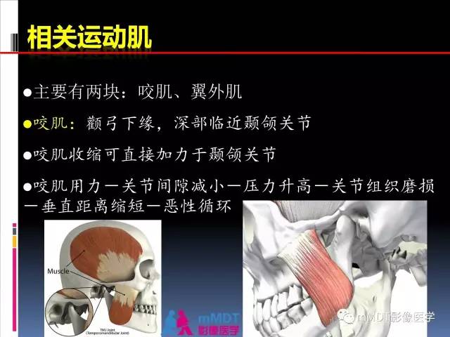 【PPT】颞下颌关节的磁共振成像(检查技术与解剖部分)