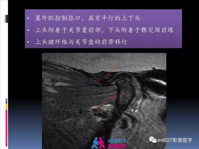 【PPT】颞下颌关节的磁共振成像(检查技术与解剖部分)