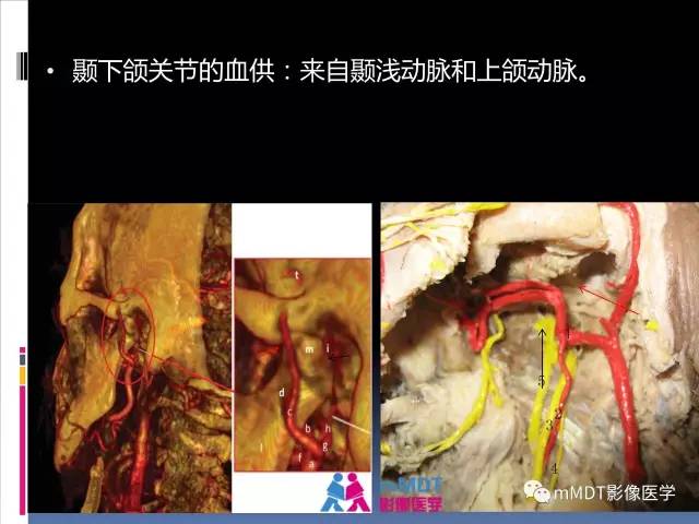 【PPT】颞下颌关节的磁共振成像(检查技术与解剖部分)