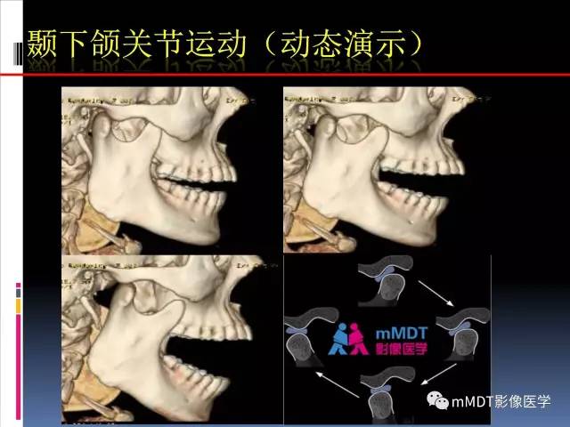 【PPT】颞下颌关节的磁共振成像(检查技术与解剖部分)