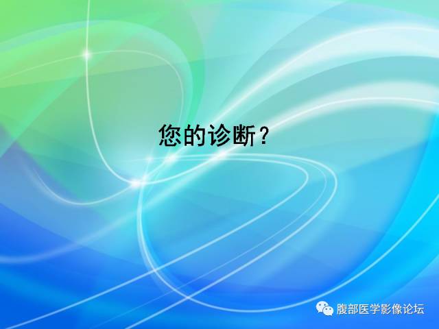 【病例】胃贲门平滑肌瘤1例CT影像表现