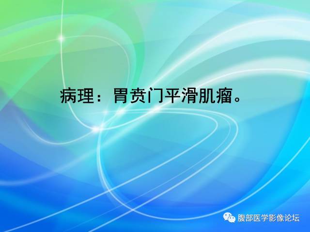 【病例】胃贲门平滑肌瘤1例CT影像表现