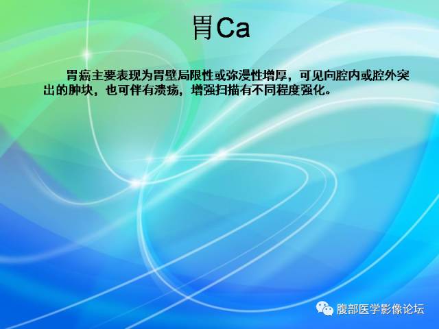 【病例】胃贲门平滑肌瘤1例CT影像表现