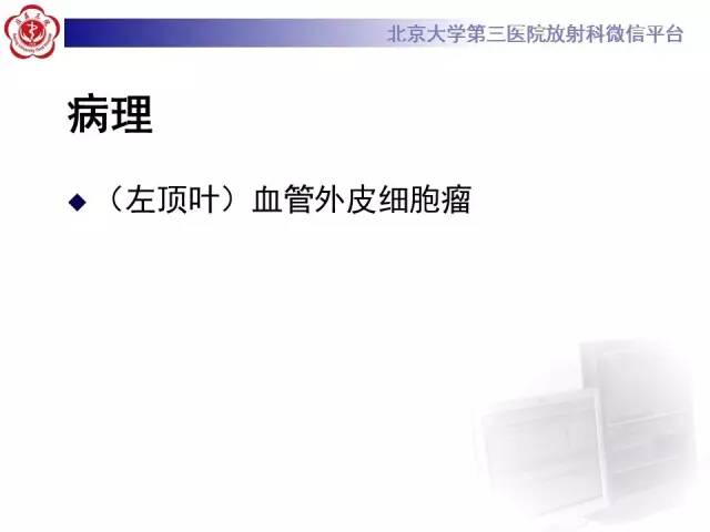 【病例】血管外皮细胞瘤/血管周细胞瘤1例MR