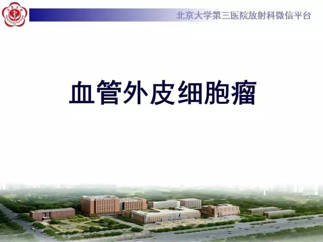 【病例】血管外皮细胞瘤/血管周细胞瘤1例MR