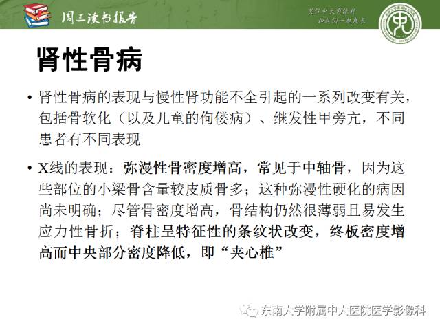 【PPT】代谢性骨病影像学表现【RG精选】