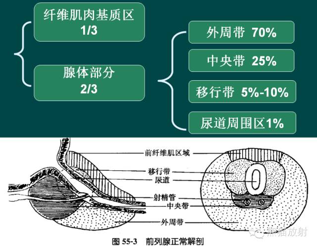前列腺癌MRI诊断与鉴别诊断 前列腺癌MRI诊断与鉴别诊断