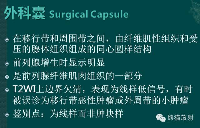 前列腺癌MRI诊断与鉴别诊断 前列腺癌MRI诊断与鉴别诊断
