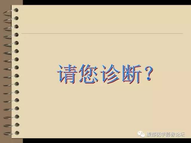 【病例】右肾癌(透明细胞肾癌)1例CT及MR影像表现