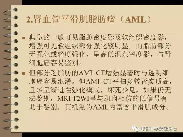 【病例】右肾癌(透明细胞肾癌)1例CT及MR影像表现