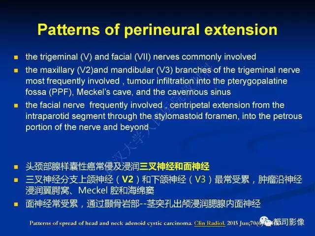 【PPT】头颈部腺样囊性癌伴周围神经浸润影像诊断