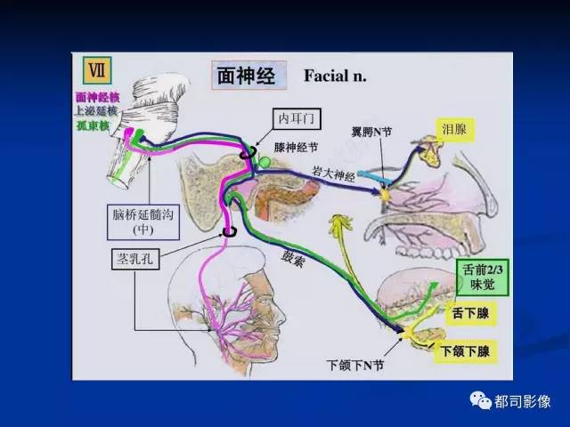 【PPT】头颈部腺样囊性癌伴周围神经浸润影像诊断