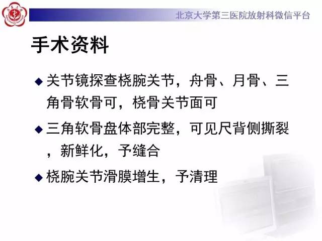 【病例】三角纤维软骨复合体损伤1例MR
