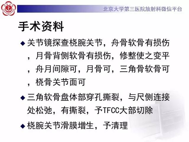 【病例】三角纤维软骨复合体损伤1例MR
