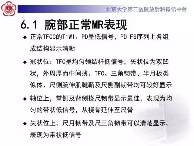 【病例】三角纤维软骨复合体损伤1例MR