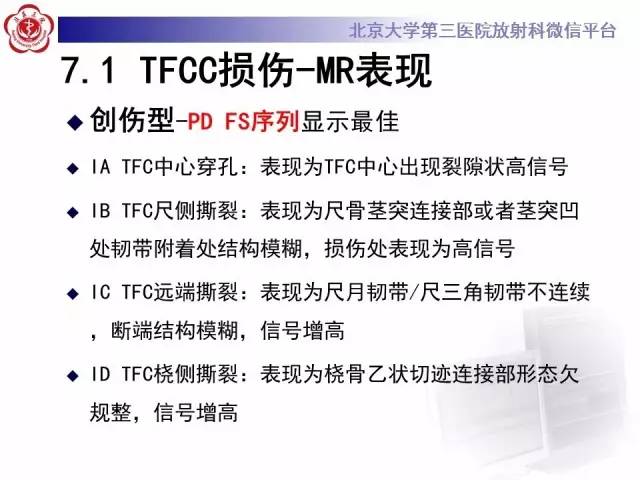 【病例】三角纤维软骨复合体损伤1例MR