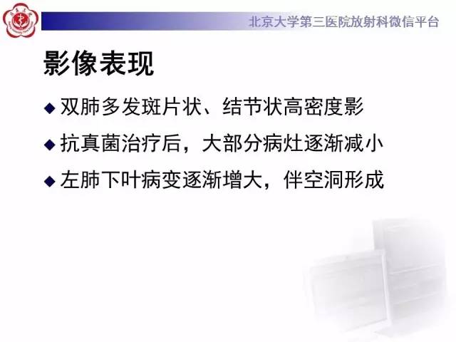 【病例】淋巴瘤并发肺癌1例CT