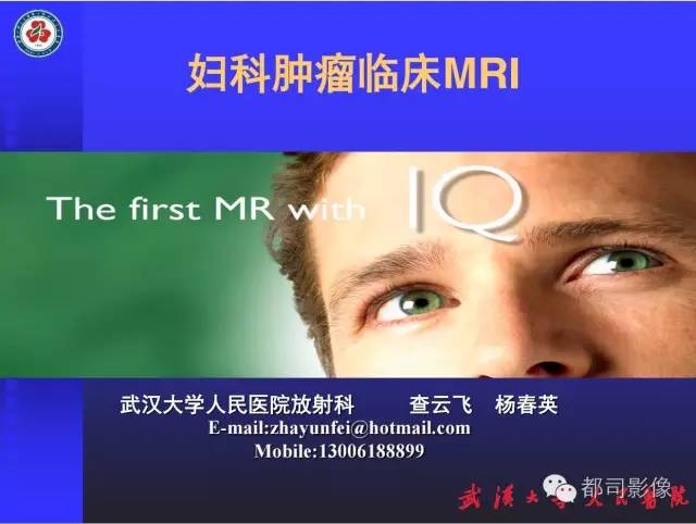【PPT】妇科肿瘤临床MRI