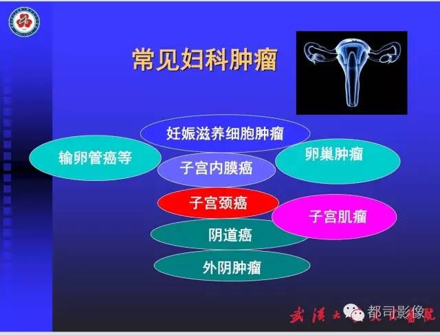 【PPT】妇科肿瘤临床MRI