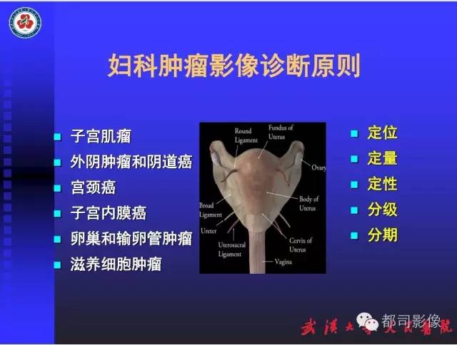 【PPT】妇科肿瘤临床MRI