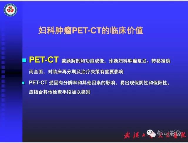 【PPT】妇科肿瘤临床MRI