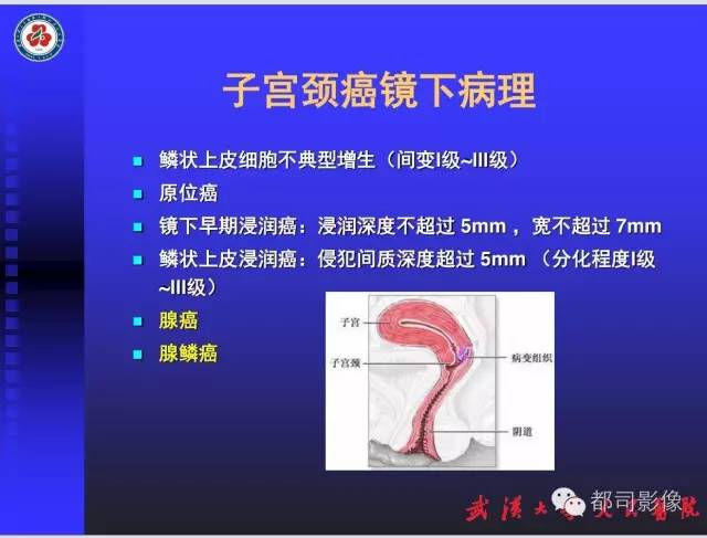 【PPT】妇科肿瘤临床MRI