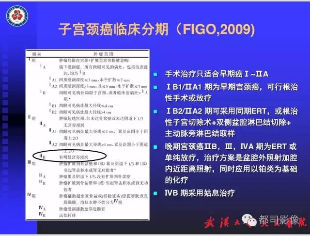 【PPT】妇科肿瘤临床MRI