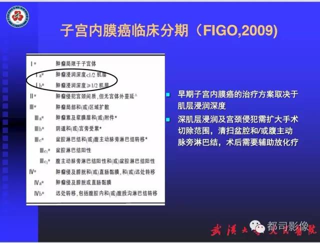 【PPT】妇科肿瘤临床MRI