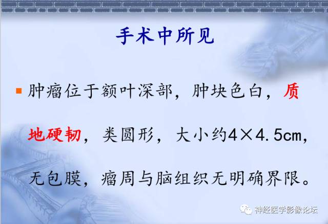 【病例】脑内常见病例的罕见影像表现——肉芽肿性炎1例MR
