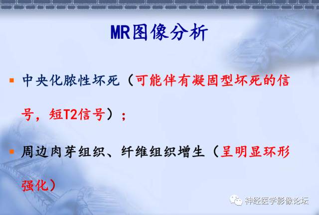 【病例】脑内常见病例的罕见影像表现——肉芽肿性炎1例MR