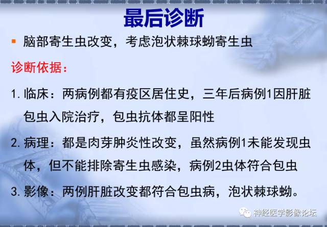 【病例】脑内常见病例的罕见影像表现——肉芽肿性炎1例MR