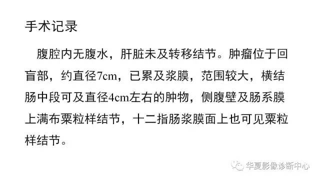 【病例】结肠结核1例CT影像表现