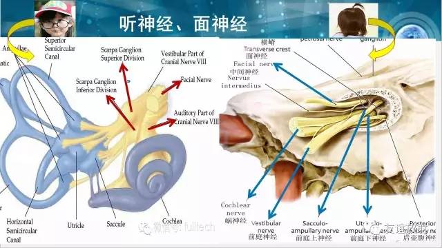 【PPT】桥小脑角区肿瘤——听神经瘤