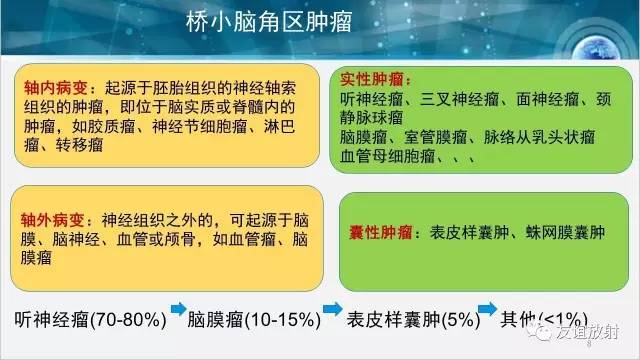 【PPT】桥小脑角区肿瘤——听神经瘤