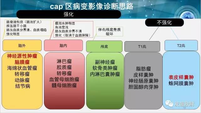 【PPT】桥小脑角区肿瘤——听神经瘤