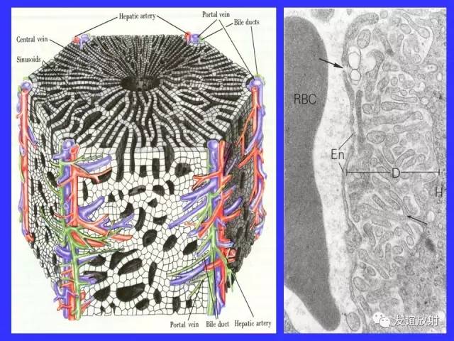 肝实质异常灌注CT、MRI评价