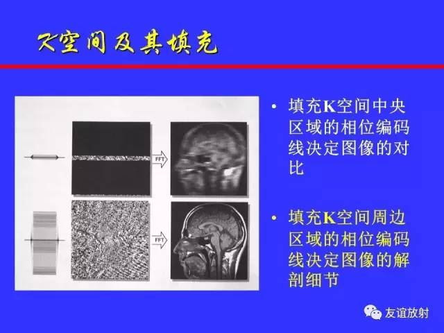 肝实质异常灌注CT、MRI评价