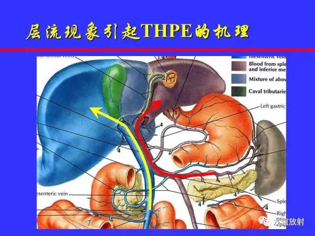 肝实质异常灌注CT、MRI评价