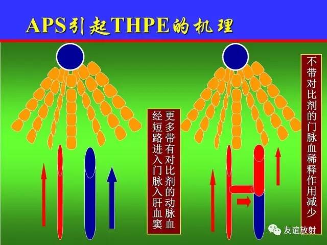 肝实质异常灌注CT、MRI评价