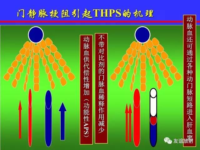 肝实质异常灌注CT、MRI评价