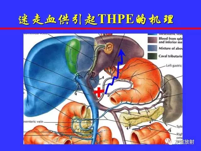 肝实质异常灌注CT、MRI评价