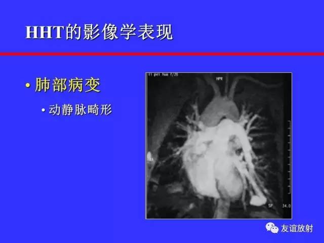 肝实质异常灌注CT、MRI评价